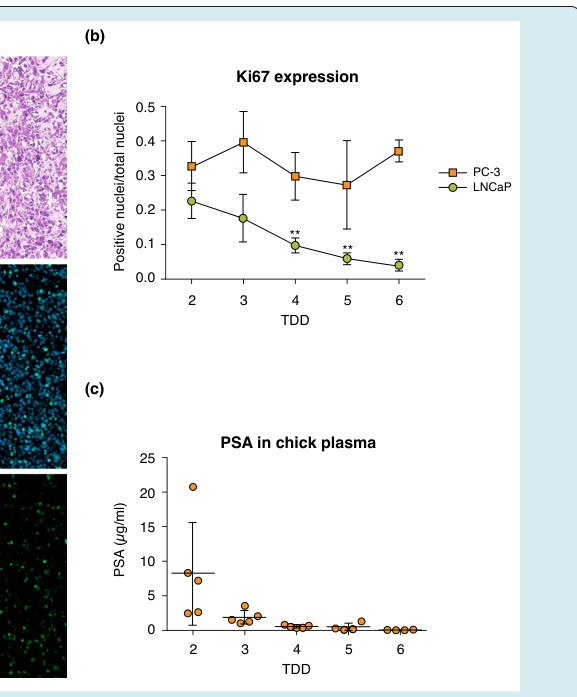 Figure 2: A schematic representation of cholesterol pathways in prostate cancer cells. Cholesterol uptake is mediated mainly by LDL via LDLR and partly by HDL via SR-BI. ABCA1 pumps cholesterol out. Cholesterol can be produced de novo via the mevalonate pathway with its rate-limiting HMGCR enzyme, target of statins. Cholesterol can be used for proliferation, converted in oxysterols and further to hormones like androgens and stored in lipid droplets. The transcription factors SREBP2 and LXR regulate cholesterol homeostasis. CYP17A1 is a rate-limiting enzyme in androgen synthesis from cholesterol. AR signalling plays a crucial role in prostatic diseases by inducing proliferation. In red pathways leading to cholesterol accumulation favouring cancer development, in green pathways decreasing intracellular cholesterol, restraining cancer progression. Adapted from [9,13].