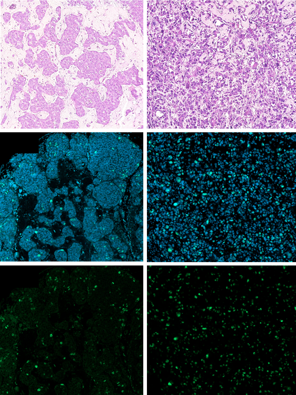 Figure 3: Ki67 immunostaining in LNCaP and PC-3 tumours grown in the CAM. A Representative HE, Ki67 and DAPI staining. B Relative quantification of Ki67 positive nuclei reported to DAPI stained nuclei (n = 4 to 6 tumours per conditions, *p < 0.05, ** p < 0.01, Student’s t-test). C PSA secreted by LNCaP tumours in chick plasma. TDD: tumour development day.