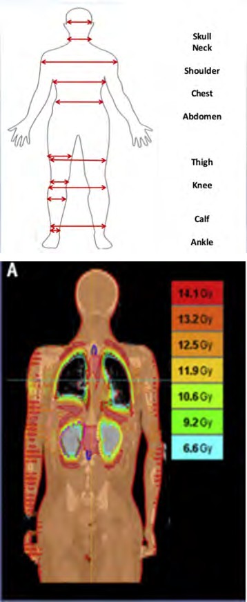 Figure 1: Thickness measurements for TBI planning.