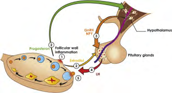 Figure 8: Courtesy ref no-2Proposed ovulation sequence. As the follicle begins to lose integrity (1) because of inflammation or LH-independent luteinization, P4 in circulation increases and E2 declines. Once P4 reaches the triggering threshold, it exerts positive feedback on GnRH signaling pathways and NPY (2). In its turn, GnRH binds to receptors in the pituitary, inducing the surge of gonadotropins, with the preferential release of LH (4) resulting from modulation by NPY (5). Gonadotropins cause the follicle to rupture, cumulus to disperse, mural granulosa cells to luteinize, and egg to ovulate. If E2 in circulation drops significantly before P4 induces LH flare, this releases LH (2), which accelerates luteinization of granulosa cells and boosts P4 to the GnRH triggering level. E2, estradiol; FSH = follicle-stimulating hormone; GnRH = gonadotropin-releasing hormone; LH = luteinizing hormone; NPY = neuropeptide Y; P4 = progesterone.