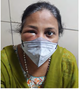 Figure 1: The patient with presenting complaints.