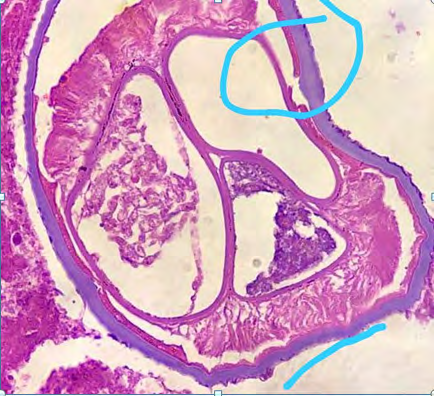 Figure 4: Microscopic cross sectional view of the worm.