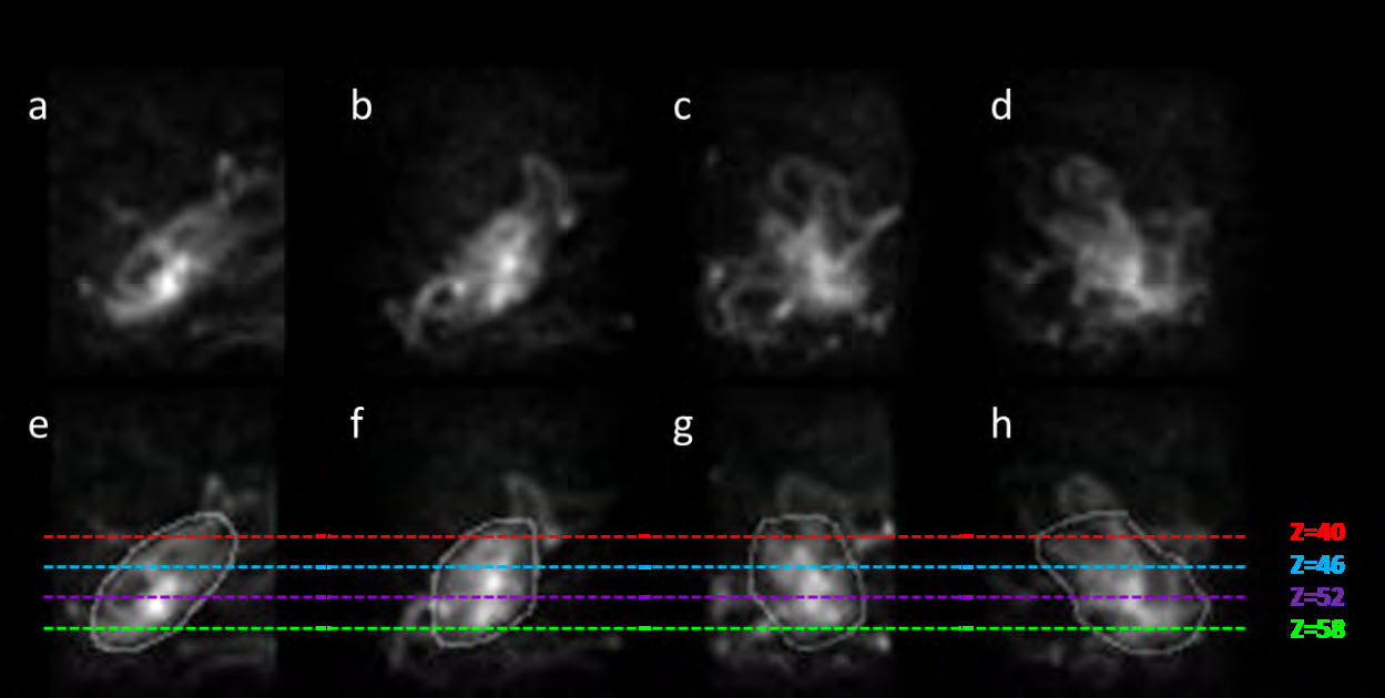 Figure 4: Top row: MIP images from different projected angles. Bottom row: Contours delineated by one of the physicists. Each horizontal dotted line crossing the MIPs indicates the z-positions used for subsequent axial reconstruction.