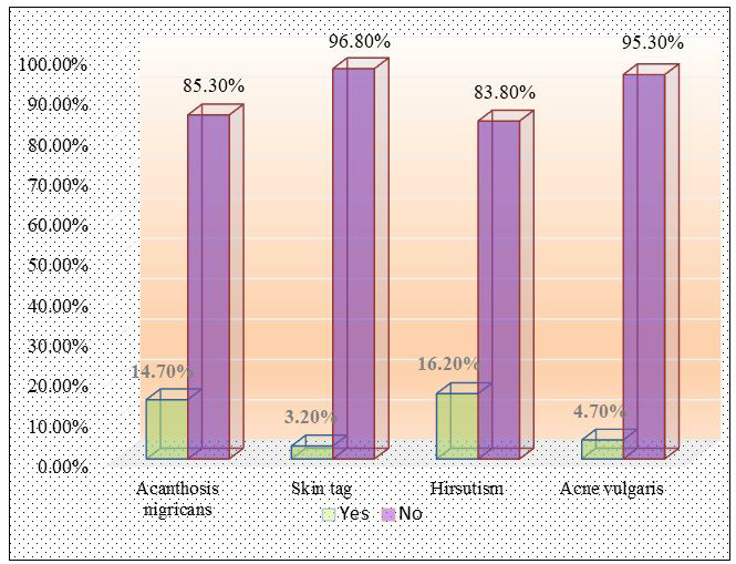Figure 4: distribution of respondent’s according to their observational check list and it is found that the highest 16.2% was Hirsutism. Another 14.7% belongs to Acanthosis nigricans, Skin tag and Acne vulgaris was found 3.2% and 4.7% among all respondents. In Dhaka, Megacity population’s growth rates are very high that’s why ensuring the quality food supply and pure drinking water in the school students are the main challenges. In a results, many students took the junk first food at the lunch time which is enhancing the obesity problems in the high school students in Dhaka Megacity.