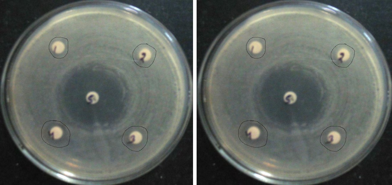 Figure 2: Plates showing inhibition of bacterial and fungal strains.