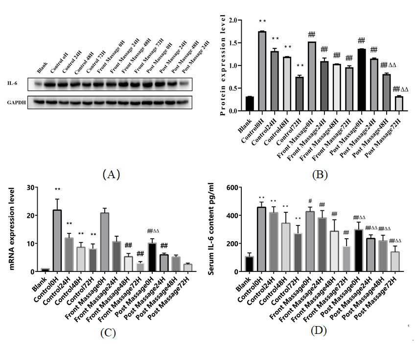 Figure 2: Changes of IL-6 expression in DOMS rats. Data were mean±SEM. A. Western blot analysis IL-6 protein expression in rats. ** P< 0.01 compared with blank group; ## P< 0.01 compared with the control group in the same period; ΔΔ P< 0.01 compared with the front massage groups in the same period; B. PCR detection for IL-6 mRNA. ** P< 0.01 compared with blank group; ## P< 0.01 compared with the control group in the same period; ΔΔ P< 0.01 compared with the front massage groups in the same period; C. ELISA showed the IL-6 content in rats. ** P< 0.01 compared with blank group; ## P< 0.01 compared with the control group in the same period; ΔΔ P< 0.01 compared with the front massage groups in the same period.