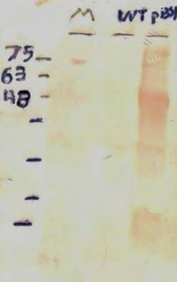Figure 10: Western blot analysis on MaSp1 protein. 1: Protein leader. 2: Total soluble WT protein. 3: Total soluble protein of transgenic plant T1.