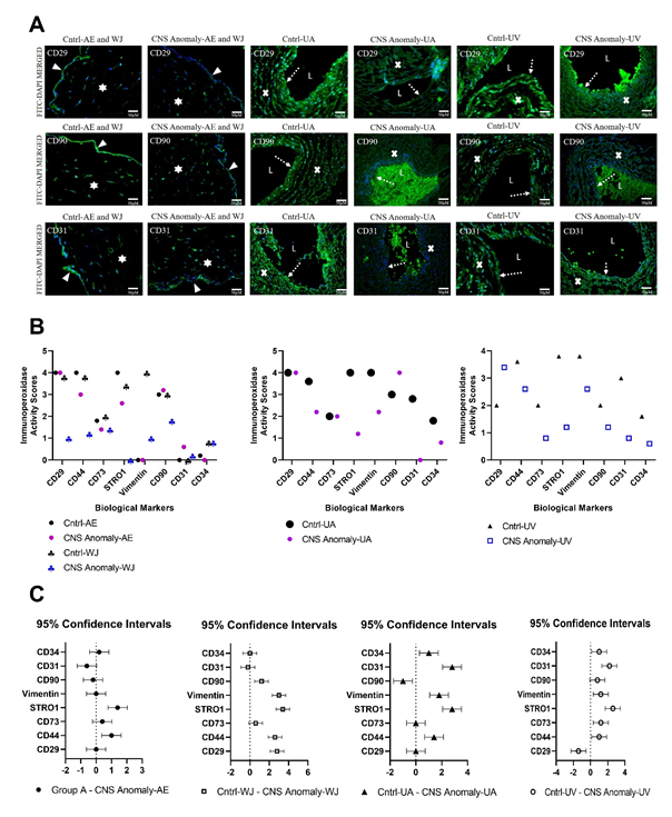 Figure 7: Among the groups, CD29, CD90 and CD31 immunofluorescence expressions are seen in the amniotic epithelium (AE), Wharton jelly (WJ), umbilical artery (UA) and umbilical vein (UV) regions. The solid white triangle symbol indicates the amniotic epithelium, the star symbol Wharton jelly, the dashed white arrow symbol the endothelial layer, the letter “L” UA and UV lumen, and the “x” symbol UA and the UV vessel wall. Microscope magnification 40x. Scale bar 50 µM (A). Immunoperoxidase activity scores between groups of biological markers in the AE, WJ, UA and UV regions are shown in the graph (B). 0: No expression, 1+: Mild expression, 2+: Moderate expression, 3+: High expression and 4+: Over expression. 95% CI was compared in fetal cords with control and CNS anomalies in the AE, WJ, UA and UV regions (C).