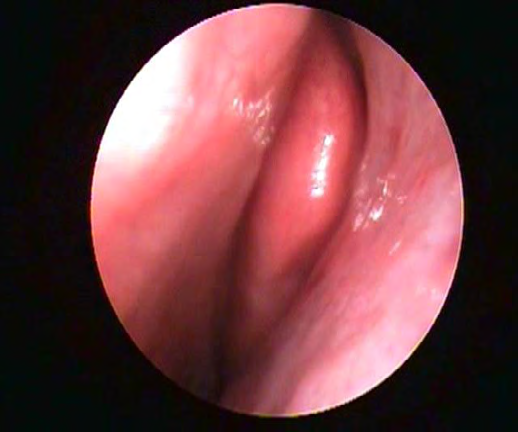 Figure 2: Post-therapy.