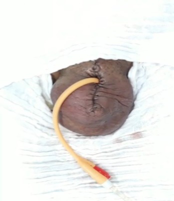 Figure 3: Urethrostomy and suture of several plants.