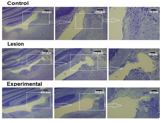 Figure 3: Coronal sections of the brain stem in control, lesion, and experimental groups to estimate of damage cavity. The Cavity volume in experimental groups is less than of damage volume in the lesion group.