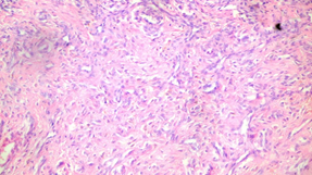 Figure 2: Observe how the synovium enters the carpal tunnel that is already open.