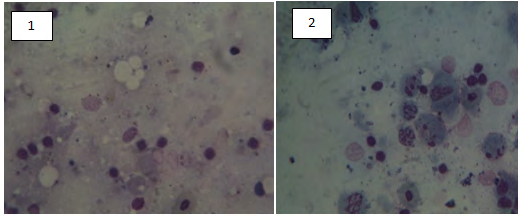 Figure 2: 1and 2 unidentified protozoa.