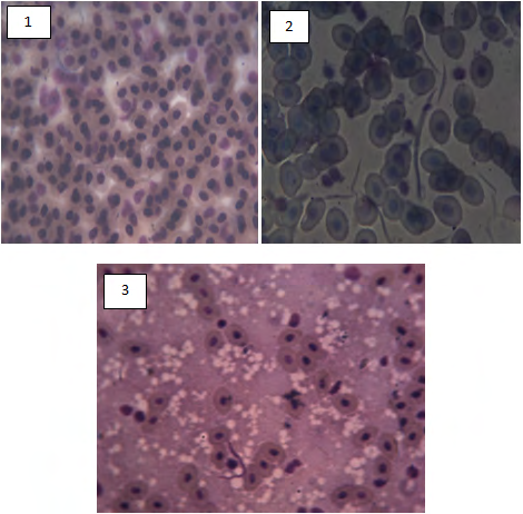 Figure 3: 1,2 Trypanosoma sp. in the blood and 3 Trypanosoma sp. in the liver.