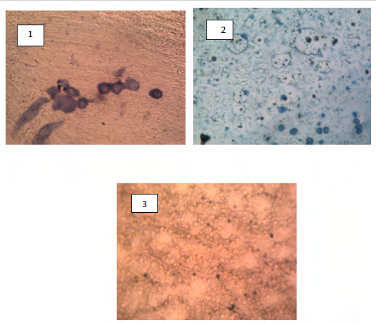 Figure 5: 1unidentified protozoa, 2 unidentified protozoa and 3 Microsporidia spp. in kidney.