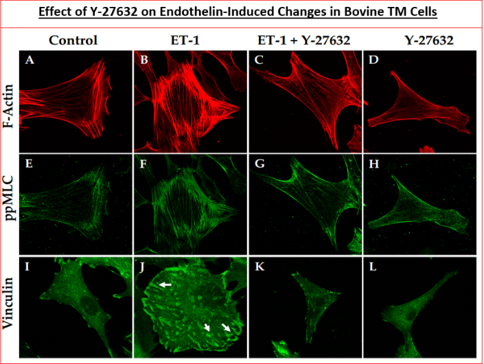 Figure 5: ROCK inhibitor effects on various cellular morphological markers.