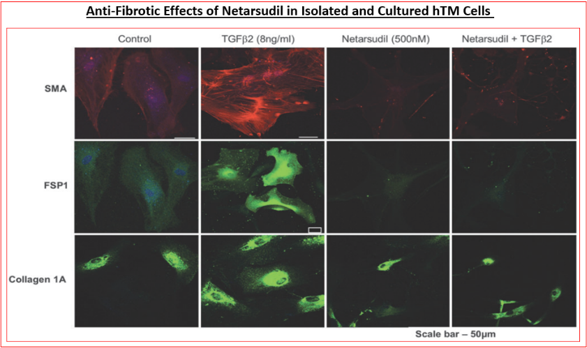 Figure 9: Inhibition of pro-fibrotic actions of TGF-β by a potent ROCK inhibitor in vitro.
