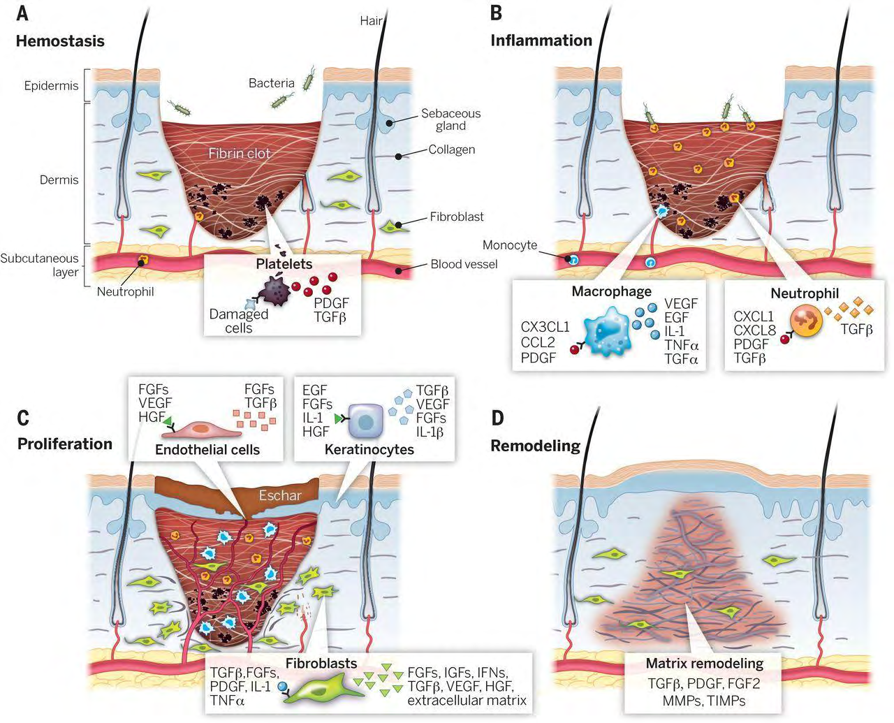 Figure 1: Stages of wound healing. It is classically divided into four stages: (A) hemostasis, (B) inflammation, (C) proliferation, and (D) remodeling. Each stage is characterized by key molecular and cellular events and is coordinated by a host of secreted factors that are recognized and released by the cells as a wounding response. Representative subsets of major factors are depicted. CCL2, chemokine (C-C motif) ligand 2; CX3CL1, chemokine (C-X3-C motif) ligand 1; CXCL1, chemokine (C-X-C motif) ligand 1; CXCL8, C-X-C Motif Chemokine Ligand 8; EGF, Epidermal growth factor; FGF2, basic fibroblast growth factor; FGFs, fibroblast growth factors; HGF, hepatocyte growth factor; IFNs, interferons; IGFs, insulin-like growth factors; IL-1, interleukin-1; IL-1β, interleukin-beta; MMPs, matrix metalloproteinases; PDGF, platelet-derived growth factor; PDGI, platelet- derived growth inhibitor; PGF2, Prostaglandin F2; TGFα, transforming growth factor-alpha; TGFβ, transforming growth factor- beta; TIMPs, tissue inhibitor of metalloproteinases; TNF-α, tumor necrosis factor alpha; VEGF, vascular endothelial growth factor (28).