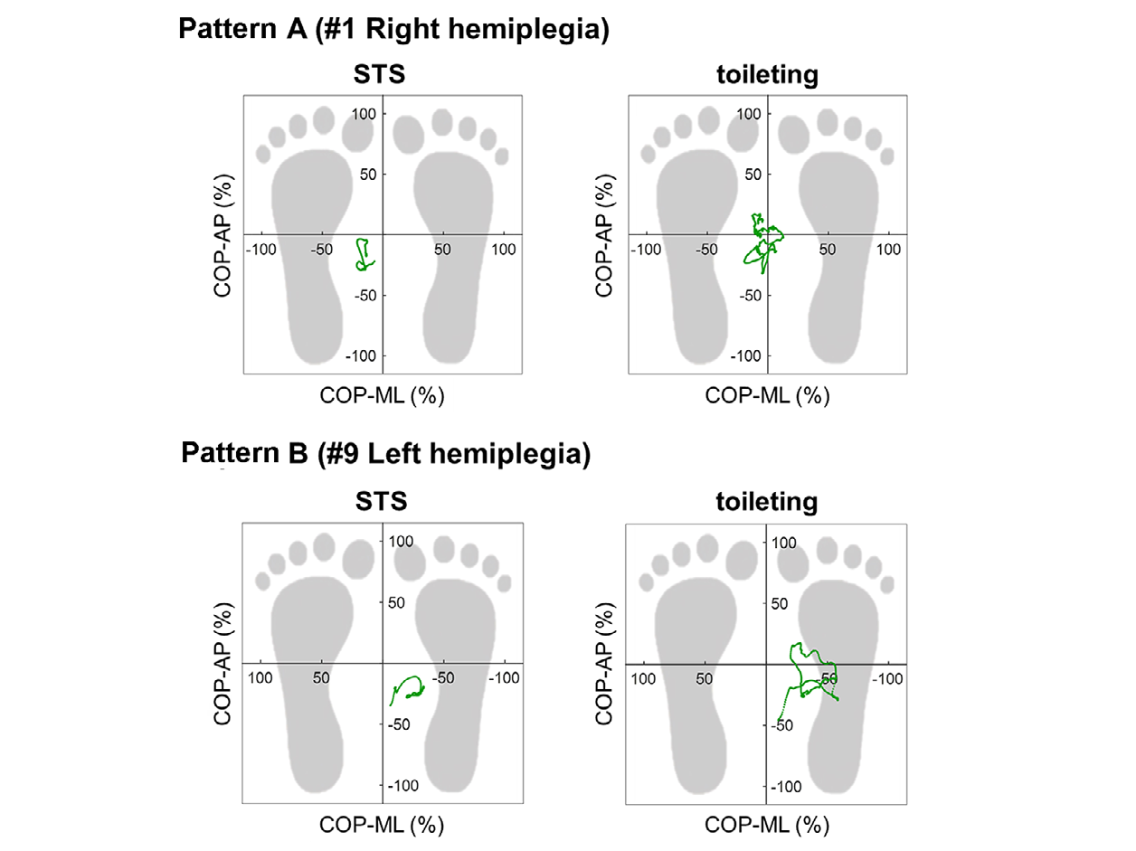 Figure 2: The difference in the transition of the COP between STS and toileting was distinguishable by two patterns. Those who showed Pattern A had increased displacement of the COP toward the paretic side during toileting compared to STS. In one example (# 1) shown in the upper panel of Figure 2, during STS, the COP trajectory changed on the non-paretic side from start to end. During toileting, however, the COP started almost at the center of the posterior direction, moved forward, backward, left, and right and moved forward from the center at the end. Eight of the 10 participants showed a pattern similar to Pattern A (# 1–8). In eight participants, the COP moved on the non-paretic side during toileting, as in STS; however, in some participants, the COP was temporarily displaced to the paretic side during motion. Participants who showed Pattern B had a greater decrease in the displacement of the COP toward the paretic side during toileting than during STS. In one example (# 9) shown in the lower panel of Figure 2, during STS, the COP trajectory was always on the non-paretic side from start to end. During toileting, the COP always remained on the non-paretic side. The displacement decreased more toward the paretic side during toileting than during STS, increasing the asymmetry. Two out of 10 participants showed a pattern similar to Pattern B (# 9–10).