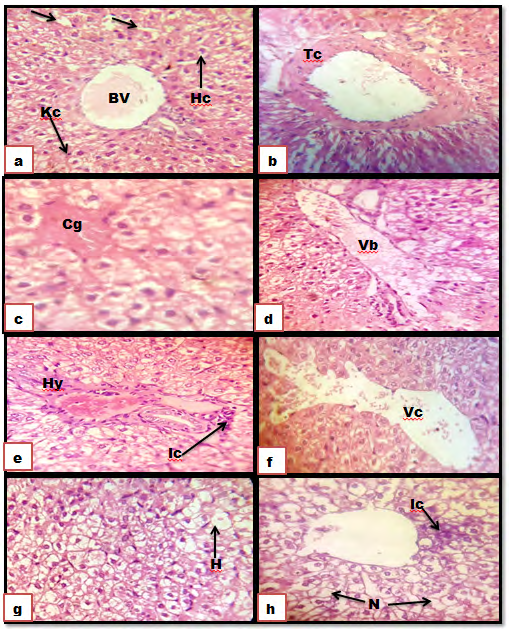 Figure 1: Photomicrographs of sections of the liver. (a): control group showing a normal architecture without pathological alterations. Hepatocyte (HP), Spherical nucleus (arrow), Sinusoids (S), Blood vessel (BV), and Kupffer cells (Kc). (b-h): IM group; showing obvious histopathological changes. Thickening in the central vein (Tc), Congestion of blood vessels (Cg), Vasodilatation in blood vessels (Vb), hyperplasia (Hy), Inflammatory cells infiltration (Ic), Vasodilatation in in the central vein (Vc), Hydropic changes (H), Necrosis (N). (HE) stain (X400).
