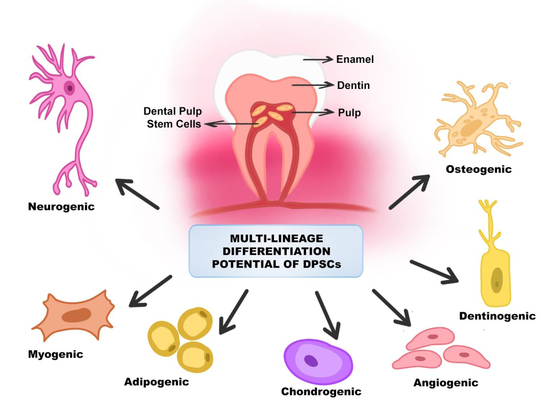 Figure 5: Similar to that of MSCs, DSPCs exhibit a fibroblast- like morphology, adhesive quality to plastic surfaces, surface marker expression, proliferation, and colony forming behavior. In addition to mesenchymal stem cell markers such as CD73, CD90, and CD105, The immunophenotype of DPSCs has been found to include another mesenchymal stem cell marker, STRO-1, which is co-expressed with CD146 and pericyte antigen, [68,72,73] DPSCs also express neural lineage markers such nestin, B III tubulin, and glial fibrillary acidic protein (GFAP), which are seen on neural stem cells [74,75].