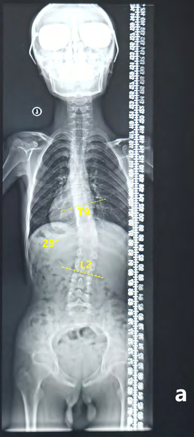 Figure 1: Before treatment.