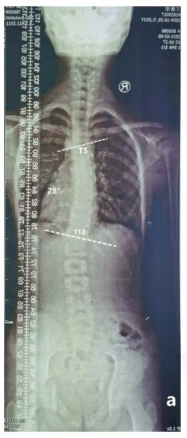 Figure 2: After treatment.