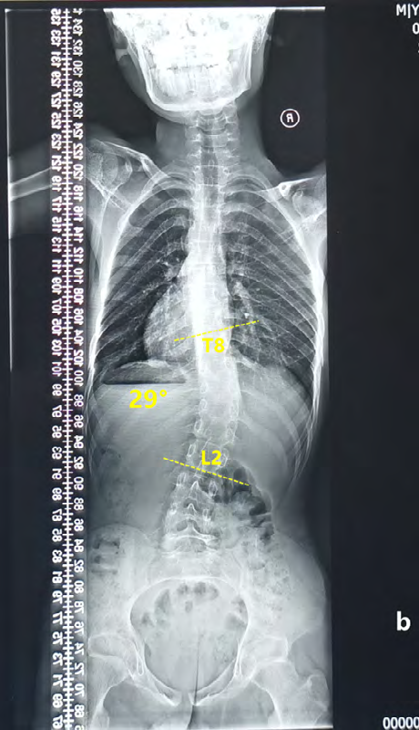 Figure 3: Before treatment.