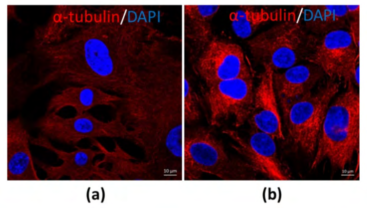 Figure 2: Courtesy ref no-10-The morphological differences between MGCs and CCs (a) MGCs at 63× magnification; (b) CCs at 63× magnification. The cells were stained by the immunofluorescence method (unpublished data).