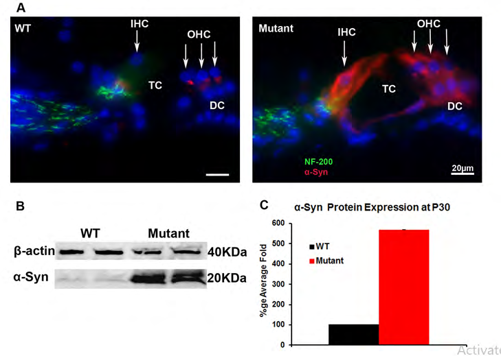 Figure 2: α-Syn protein expression in the WT and transgenic (mutant) mice cochlea: Immunofluorescence. was used to detect α-Syn and neurofilament protein expression using anti α-Syn antibody (Red) and anti-neurofilament 200 (NF200, green) antibodies (Figure 2A). The α-Syn protein localizes predominantly to the base of the cochlear OHCs and weak labeling to the base of the IHCs in WT. In transgenic mice over-expressing α-Syn, staining is seen in many cell types in the OC, including IHCs, OHCs, and Deiters’ cells (Figure 2A). This increase of the α-Syn protein in the transgenic was further demonstrated by western blot (Figure 2B) and quantified in Figure 2C relative to the protein β actin. OC: organ of Corti; DC Deiters’ cells; TC: Tunnel of Corti. OHC: outer hair cells; IHC: inner hair cells.