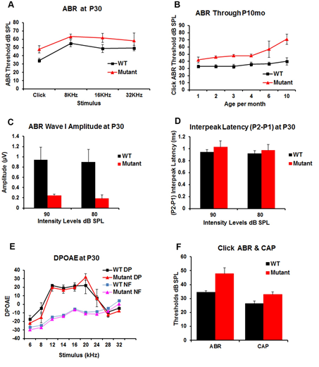 Figure 3: Auditory function was tested in WT and transgenic (mutant) mice to determine the effect of α-syn over-expression on hearing function. Acoustic brainstem response (ABR) testing (Figure 3A) at P30 demonstrates a statistically significant increase of ABR threshold of about 15dB in transgenic mice for click and pure tones (8, 16 and 32 KHz) stimuli; Figure 3B shows the changes in hearing in the transgenic and WT mice over time as measured by click ABR at P1-10months. This demonstrates an elevated ABR threshold (~10-20 dB) in the transgenic vs. WT littermates that remains relatively stable until P4mo then progressively elevate in the transgenic as compared to WT mice to reach ~30dB at P10mo. Figure 3C demonstrates a significant decrease in ABR wave I amplitudes in the transgenic mice measured at two different intensity levels (80, and 90 dB SPL) when compared with the WT littermates. Figure 3D, ABR P2–P1 interpeak latencies showed a non-significant increase at P30 in the transgenic when compared to the WT mice. Distortion product otoacoustic emissions (DPOAE) at P30 (Figure 3E) showed no differences between the WT and the transgenic mice. DP means (DPOAEs) and NF means (Noise Floor). Comparison of click ABR and CAP thresholds in the WT (n=4) and transgenic (n=6) mice. Which demonstrated threshold elevation is maintained in CAP measurements but has a lower magnitude (~8dB difference between WT and transgenic) than the one observed for ABR (Figure F).