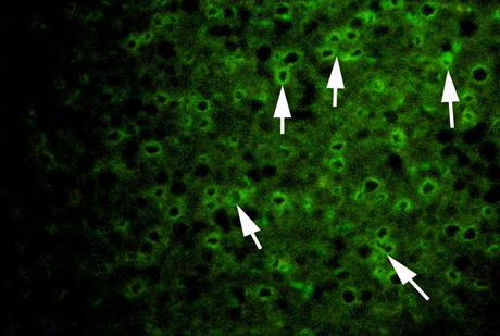 Figure 5: Vtg analysis in the plasma of local fish samples on non-reduced SDS-PAGE 8-16% gradient gel. Vtg was detected by the universal antibody after Western transfer to nitrocellulose paper following electrophoresis. MW markers; 1: Sobaity from clean water; 2: Sobaity; 3: Shaem-1; 4: Shaem-2.