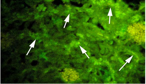 Figure 6: SDS-PAGE analysis using 12% polyacrylamide- SDS gel. 1-4, control (15 and 30 µl were loaded respectively); molecular weight marker lane 5; 6-7, low EE2 (15 and 30 µl were loaded respectively).