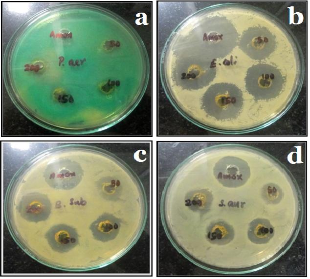Figure 1: The extract exhibited pronounced activity against all the bacterial strains tested. The activity of extract against S. aureus at the concentration 200 µg/mL was comparable with that of standard drug amoxicillin.