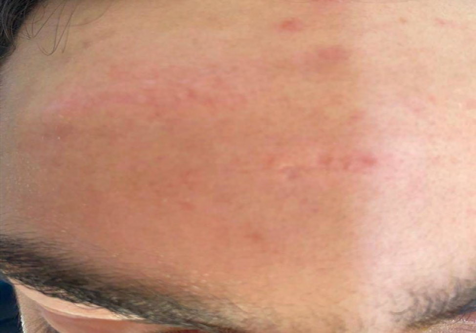 Figure 4: Control of the scar.