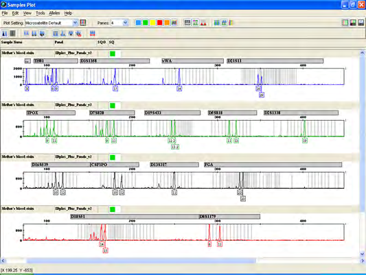 Figure 11: Electropherogram of Case study 1-Exhibit C.