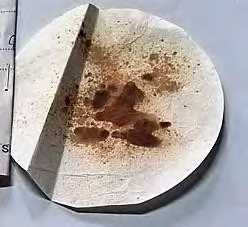 Figure 5: Case 2_Exhibit A_Liquid blood of mother. Figure 6: Case 2_Exhibit B_Liquid blood of accused father. Figure 7: Case 2_Exhibit C_Cord blood stain of the still born baby.