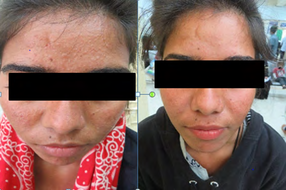 Figure 1: Before and After Treatment.