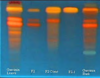 Figure 1: TLC of the Garcinia leaves and stem bark methanol extracts and fractions obtained by preparative HPLC (F2-1: Morelloflavone). Mobile phase: ethyl acetate /methanol/ formic acid/ water (20:5:1:4), spray reagent: 2-Aminoethyl diphenylborinate- Polyethylene Glycol (1:5, v/v) in 100 mL methanol.