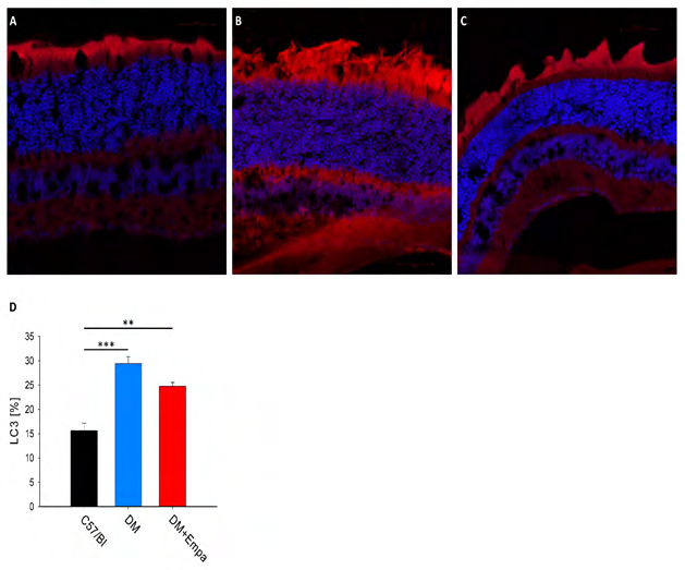 Figure 6: LC3 expression % in GCL retina in the three experimental groups. A. representative photographs taken from a C57 mice, B. DM mice, C. DM+EMPA mice. D. summary of measured LC3 expression, presented in % of tissue area.