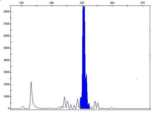Figure 2: Clonality assessment. GeneScan results of the gene rearrangement profile in the sample patient, showing the peak clonal TCRG rearrangement with multiple primer sets in a polyclonal background. Gene rearrangement of TCRB and polyclonal tonsil biopsy FFPE control are not shown.