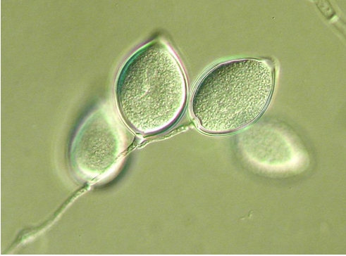 Figure 2: Spores of Phytophthora palmivora (Source: Alchetron).