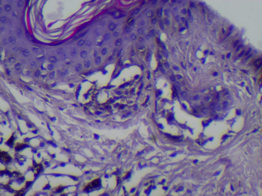 Figure 9: Histological image of the superficial layers of the dermis.