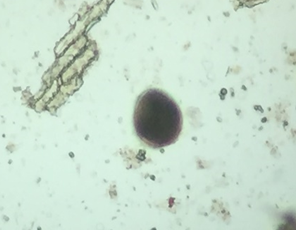 Figure 10: Photomicrograph of Toxocara spp. egg from Tiger (Devika).