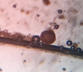 Figure 11: Photomicrograph of Toxocara spp. egg from female leopard.