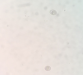 Figure 2: Photomicrograph of Isospora spp. oocyst from Civet cat.