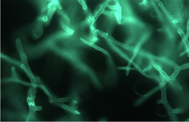Figure 4: _Lichtheimia «corymbifera_» culture on Sabouraud agar.