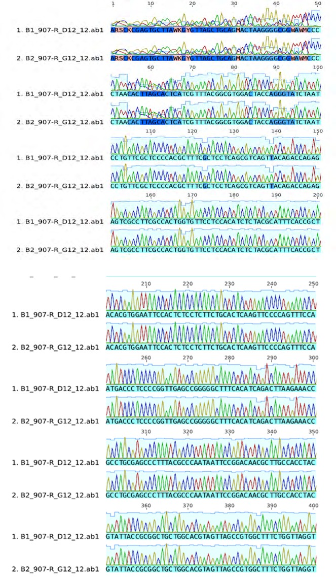 Figure 4: DNA molecules of the typed bacteria known as DNA sequencing.
