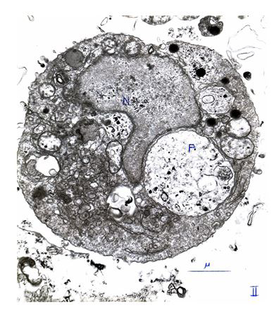 Figure 2: Spheroïdal Monocyte. N (Nucleus); P (Phagosome).