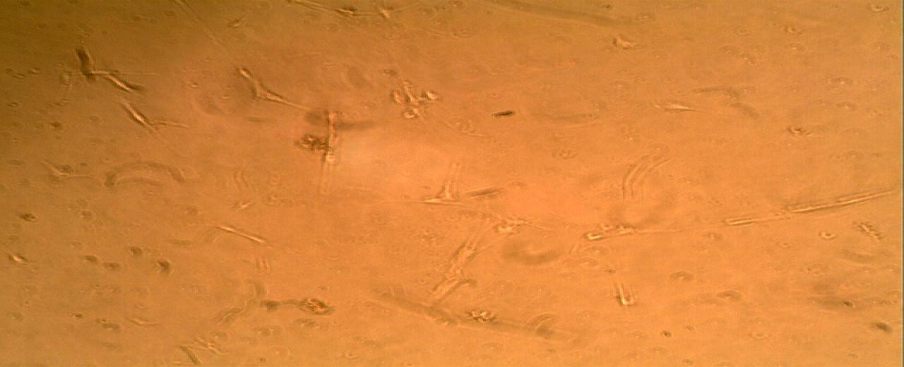 Figure 1: Normal peripheral nerves after treatment with bFGF exhibited a very sparse cell population (0.4 x 103/ ml) of largely bipolar cells (arrows) (x 200).